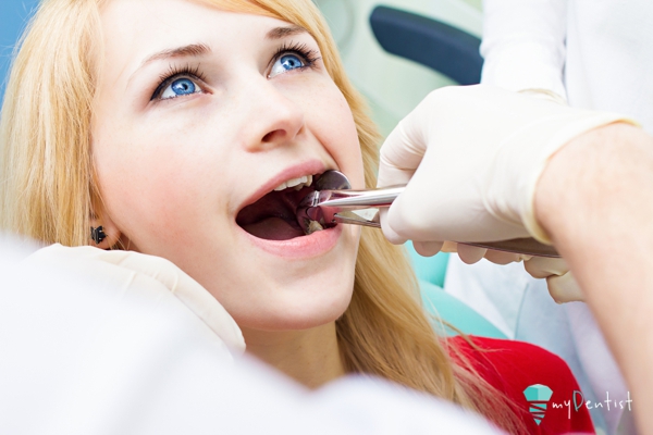 Tooth extraction
